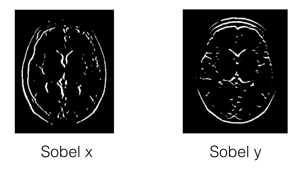 Sobel x and y filters (left and right) applied to an image of a brain